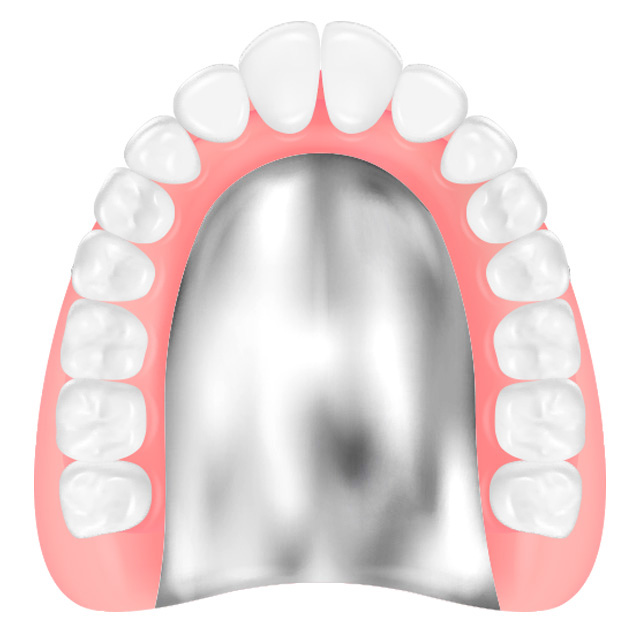 チタン床義歯