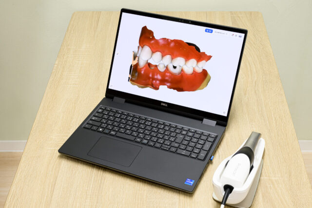 口腔内スキャナー